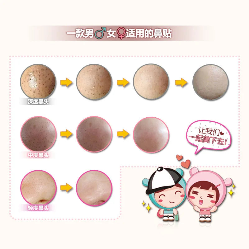 Mild Blackhead Cleaning Sticker To Remove Blackheads  Nose Sticker Nose Mask To Shrink Pores T-Zone Care Skin Care